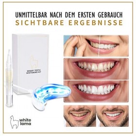 Kit de blanchiment des dents WHITELAMA dorigine, kit de blanchiment des dents intelligent développé en Europe, blanchiment d