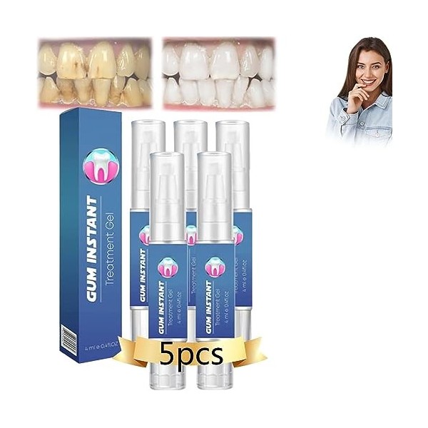 ATTDX Lot de 5 gels de traitement immédiat en caoutchouc pour blanchiment des dents, gel ATTDX, gel de caoutchouc ATTDX, gel 