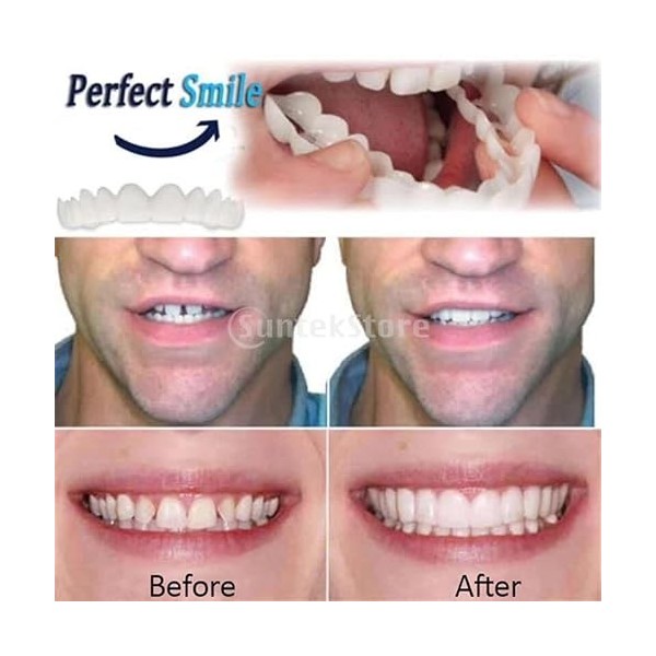 ＡＷＨＡＯ Moldable Upper & Lower Veneers Temporary False Fake Cosmetic Tooth Cover