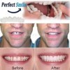 ＡＷＨＡＯ Moldable Upper & Lower Veneers Temporary False Fake Cosmetic Tooth Cover