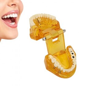 Modèle Dentaire Transparent, Modèle Pathologique Dentaire Modèle de Dents de Maladie Transparente Structure Claire Modèle Da