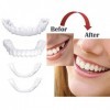 XLBHSH 2 Pair of Cosmetic Teeth, Dentier Supérieur Et Inférieur, Dentures, Temporary Smile, Dental Veneer, Quick Dental Provi