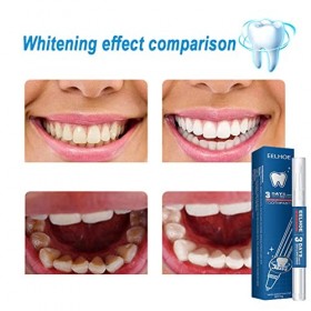 Stylo Blanchiment Des Dents,Gel de Blanchiment des Dents, Teeth Whitening Pen,2 Pcs Blanchiment des Dents pour Dents sensible