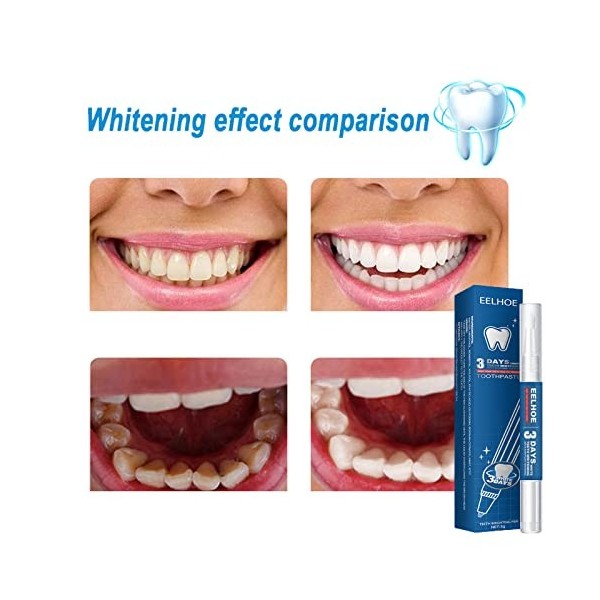 Stylo Blanchiment Des Dents,Gel de Blanchiment des Dents, Teeth Whitening Pen,2 Pcs Blanchiment des Dents pour Dents sensible