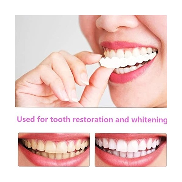 Prothèse Dentaire Cosmétique,Dentier Sourire Parfait,Faux Dents Temporaires,Amovible Prothèses Dentaires Provisoires,Alternat