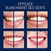 28x Blanchiment dentaire professionnel White Stripes - Sans douleur - Eclaircissement des dents - Blanchiment des dents - Den