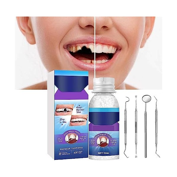 Reparador Perlas Dientes,Reparador Perlas Para Dientes,Moldable False Teeth,Reparador Perlas Dental Tooth Repair Kit for Fill