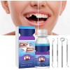 Reparador Perlas Dientes,Reparador Perlas Para Dientes,Moldable False Teeth,Reparador Perlas Dental Tooth Repair Kit for Fill