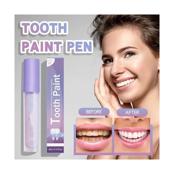 Stylo de blanchiment des dents, gel de blanchiment des dents, correcteur de couleur des dents, résultats instantanés, kit de 