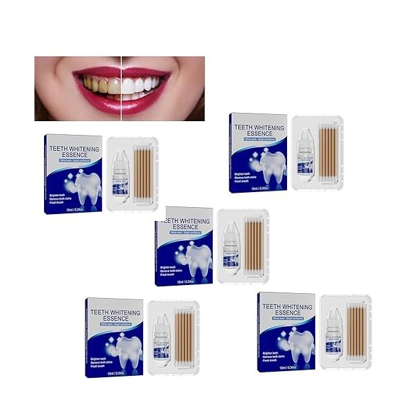 Smile Essence, Kit dessence de blanchiment des dents, Kit de blanchiment des dents, Essence de blanchiment des dents, Booste