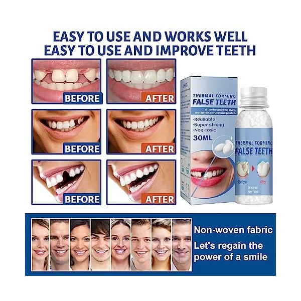 Brigtviee Teeth Repair Kit Remplissement des Dents Provisoires - Perles De Réparation Temporaire pour Les Dents Manquantes - 