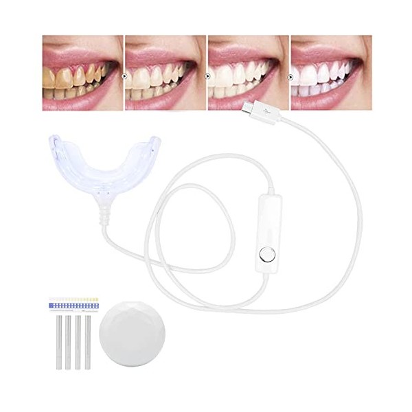Kit de Dispositif Déclairage de Blanchiment des Dents avec 4 X Gels de Blanchiment, 1 X Carte de Contraste des Dents et 1 X 