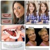 FEFCK Prothèses Dentaires Cosmetic Teeth Facettes Instantanées Kit De Prothèses À Encliqueter sur Les Dents De Sourire Haut E