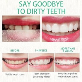 BSITSSS Nouveau 36 Pièces Blanchiment Dentaire Bande, Bandes de Blanchiment des Dents Non Sensible kit blanchiment dentaire p