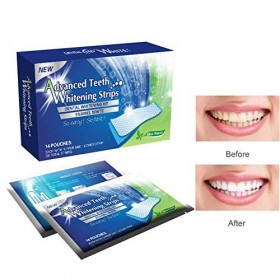 Magiin 14 pcs/set Blanchiment des Dents, Bandes Blanchiment Dentaire, Traitement de Blanchiment des Dents pour Donne un Coup 