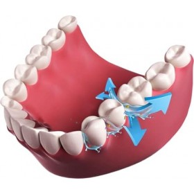 Revodent ®, nettoyage interdentaire, pâte spéciale à base de particules microcristallines, vegan, barrette bleue, Austria Pre