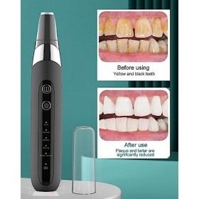 Kit de retrait de tartre et de plaque dentaire haut de gamme avec 5 modes, USB-C, étanche IPX 6