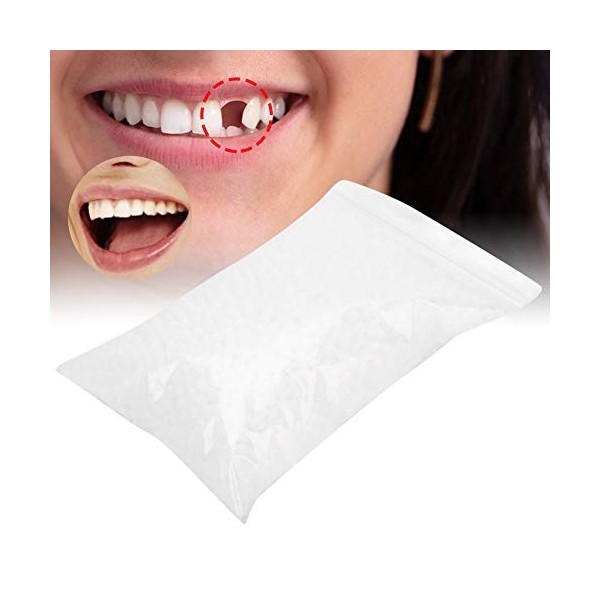 Kit de réparation de dents provisoires - Dents instantanées - Perles adhésives thermiques - Kit de réparation de dents tempor