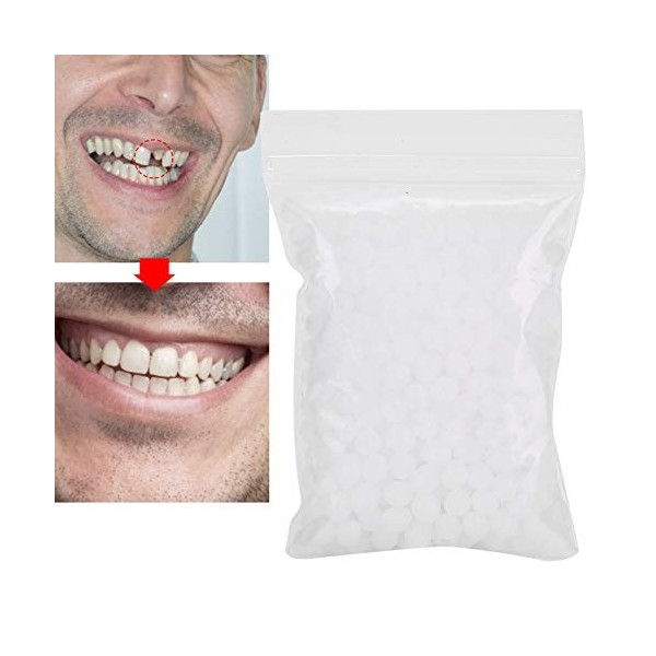 Kit de réparation de dents provisoires - Dents instantanées - Perles adhésives thermiques - Kit de réparation de dents tempor