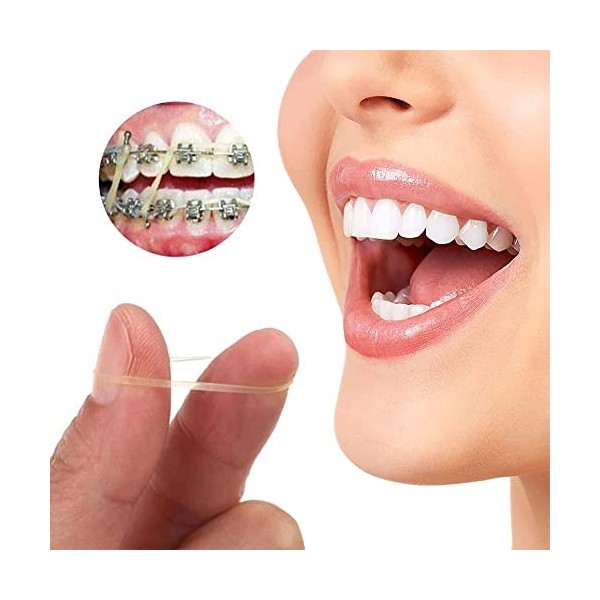 Élastiques Orthodontiques,Élastiques Dentaires en Caoutchouc,300Pcs Élastiques Dentaires en Caoutchouc Orthodontique,Outil De