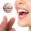 Élastiques Orthodontiques,Élastiques Dentaires en Caoutchouc,300Pcs Élastiques Dentaires en Caoutchouc Orthodontique,Outil De