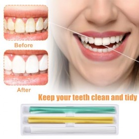 Lot de 75 feuilles de papier abrasif dentaire, bandes de polissage dentaire, taille – 4 mm de large, kit de polissage dentair