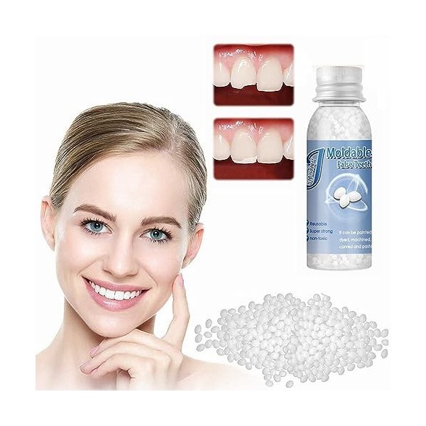 https://jesenslebonheur.fr/deals1/328899-large_default/kit-de-dent-provisoire-reparation-protheses-dentaires-instantanees-reparation-temporaire-des-dents-fausse-dents-moulables-kits-d.jpg