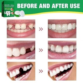 Kit de Réparation de Dentaire, Dent Provisoire, Perles Solides Dentaires, Pour Reparation dent Cassée, Matériau de Remplissag