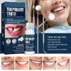 Kit de Soins Dentaires 5 en 1, le Kit de Réparation de Remplissage Dentaire Comprend une Perle de Remplissage Temporaire des 