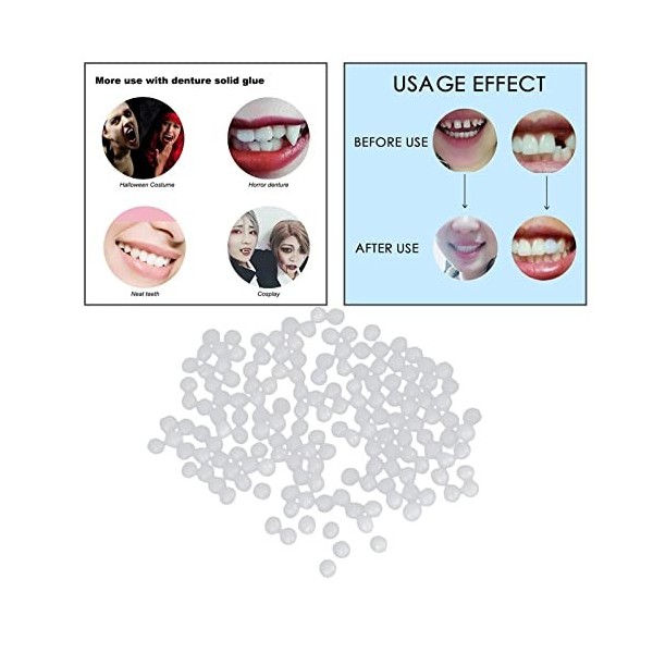 Jojomis Kit de réparation temporaire pour dentier avec perles thermiques, utilisé pour les dents cassées, les grands espaces,