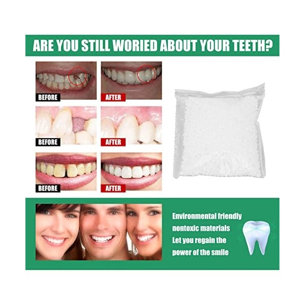 Kit de Réparation de Dents Temporaires 50 G, Perles de Fixation Dentaires pour Réparer la Dent Cassée Manquante, Fausses Dent