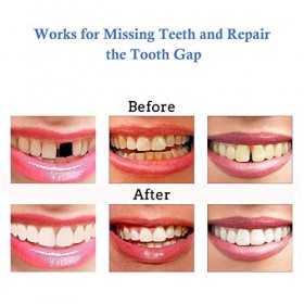 Perles de Réparation Dentaire Temporaires, Perles Thermiques de Remplissage Dentaire, Kit de Réparation Dentaire, perles de r