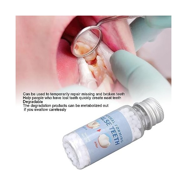 20g De Perles De Réparation De Dents Temporaires, Perles Dajustage Thermique Moulables Fausses Dents Pour Le Remplissage Des