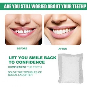 Kit de Réparation Dentaire Temporaire Kit de Remplacement de Perles Thermiques pour le Remplissage des Dents Pour Réparer les