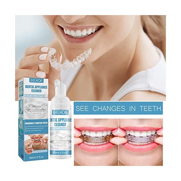 Retainer Cleaner - Nettoyage Pour In-visalign & Clear Trays/Aligners | Retainer Cleaner Détachant | Le Nettoyant Pour Protège