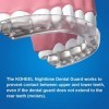 KOHEEL Gouttiere dentaire, facile à mouler, arrête le bruxisme, Protège-dents pour le grincement des dents la nuit, 5 pièces 