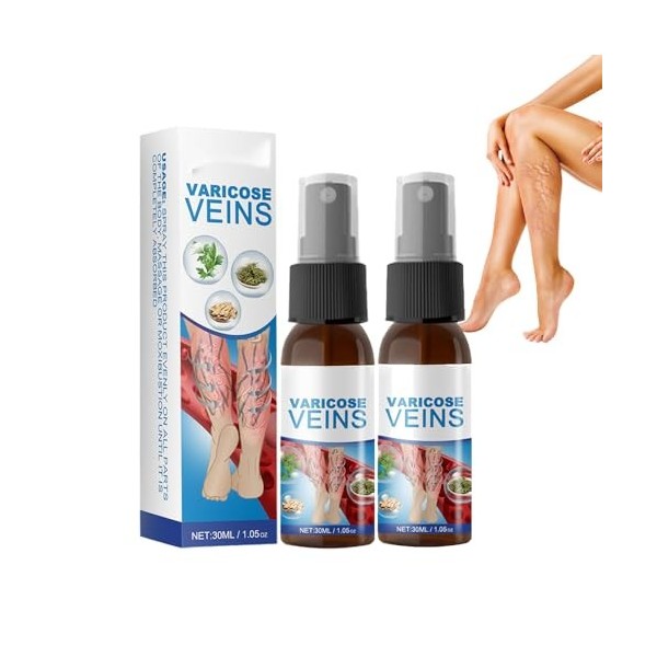 Keeoysie cream, 2 pcs sprays Veinhealing Veins，Varicose Veins Spray de guérison veine,varices pour le traitement des jambes,a