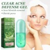 Crème Aloe Vera Acne, Gel à L’Aloe Vera, Gel dAloe Vera Bio,Apaisante et Hydratante, Réparatrice Coups de Soleil et Cicatric