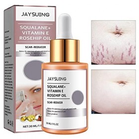 tacery Huile de Vitamine E,Dissolvant de Cicatrice Naturel | 1 FL. Oz Organic Scar Gel Cream avec extrait de pour Cicatrice c