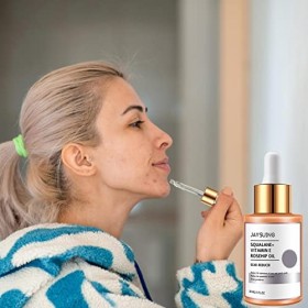 HANWEN Huile délimination des Cicatrices | Dissolvant de Cicatrice Naturel,Dissolvant de Cicatrice, 1 FL. Oz Scar Cream avec