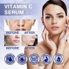Vitamine C pour le visage - Ridules autour des yeux - Hydratant - Hydratant - Soin de la peau - Hydratant - Soin du visage - 