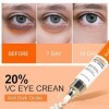 Crème contour des yeux anti-rides et anti-âge à la vitamine C pour éclaircir le teint des pattes doie - Hydrate et hydrate -