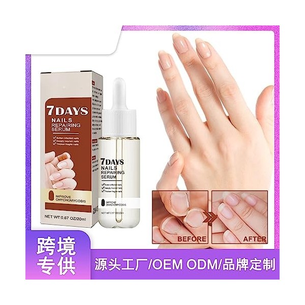 Ninge Lot de 2 sérums pour la croissance des ongles et le renforcement des ongles - Essence darmure - Pour réparer les ongle