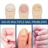 Lot de 32 patchs de traitement fongique pour ongles - Effet fongique pour orteils et ongles - Pour restaurer les ongles endom