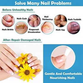 Lot de 4 crayons de réparation à lhuile pour cuticules - Anti-champignons - Pour ongles des pieds - Extra fort - Traitement 