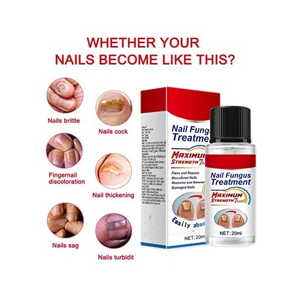 Traitement des ongles fongiques 20 ml, traitement des champignons extra fort pour ongles des pieds et des ongles, éliminateur