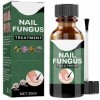 Traitement fongique des ongles, 50 ml pour ongles des orteils, traitement des ongles des orteils, kit de réparation des ongle