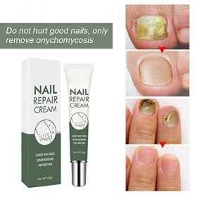 20 G Soin et Traitement des Ongles, Gel Réparateur des Ongles, Traitement des Ongles des Pieds, Répare, Répare et Protège con
