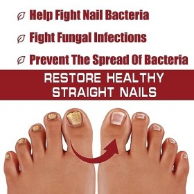 Traitement fongique des ongles, traitement des ongles dorteils extra fort, réparation des ongles