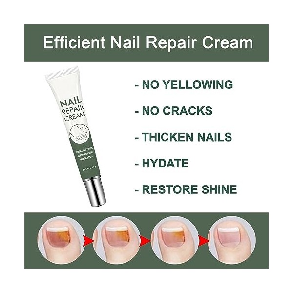 Crème réparatrice pour ongles, traitement fongique des ongles, traitement fongique. Facile à appliquer et à utiliser.